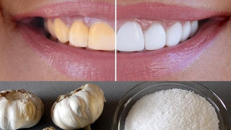 Teeth Whitening at Home in 2 Minutes! Naturally Whiten Yellow Teeth with Garlic & Salt (100% Effective!)